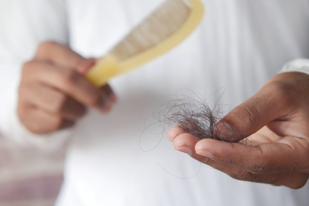 Perte de cheveux : un salon innovant à Toulouse pour retrouver confiance