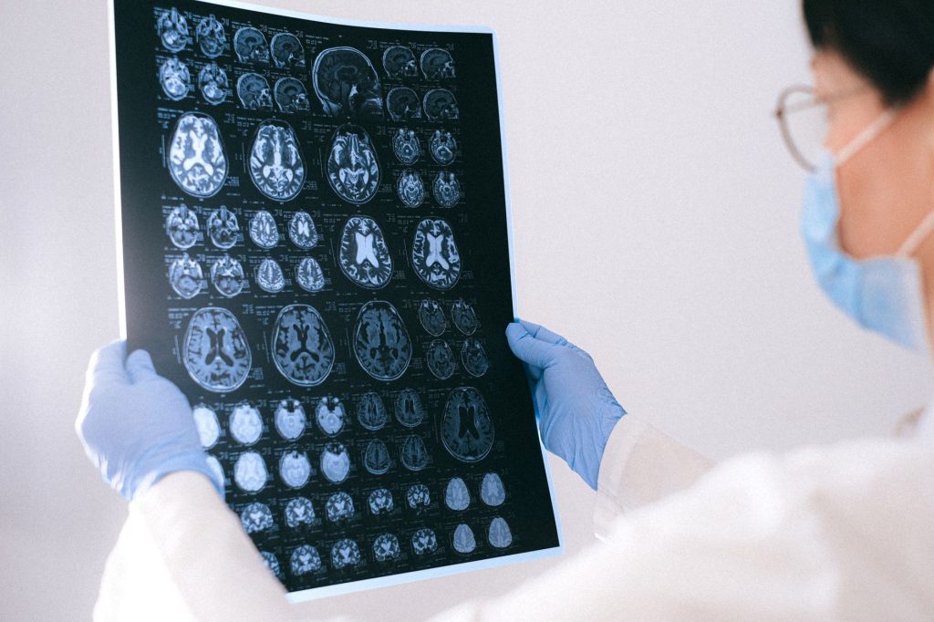 Un nouvel espoir pour les familles touchées par la maladie d'Alzheimer à Toulouse